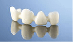 オールセラミック ブリッジ | 市ヶ谷・歯医者