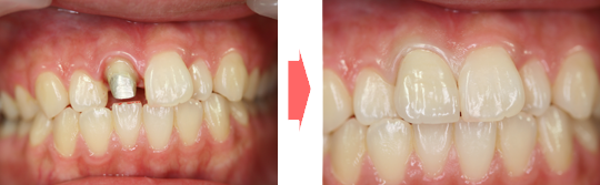 実際の治療症例 | 市ヶ谷・歯医者