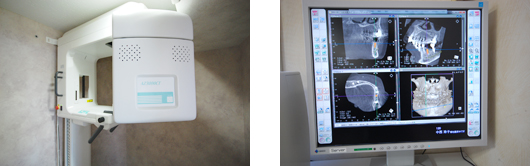 CTスキャン | 市ヶ谷・歯医者