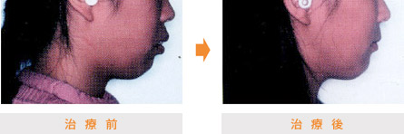 口元の変化 | 市ヶ谷・歯医者