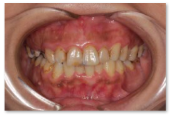 審美歯科の症例 | 市ヶ谷・歯医者