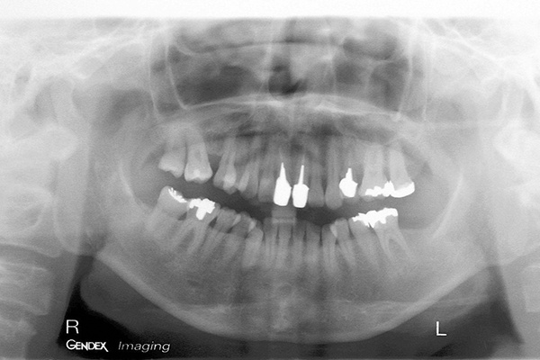 審美歯科の症例 | 市ヶ谷・歯医者